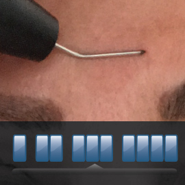 plasma frazionato ®